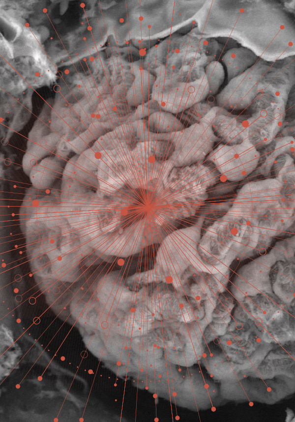 メディカルLVSEM研究会