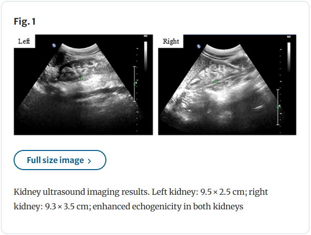 Application of low-vacuum scanning electron microscopy and energy-dispersive X-ray spectrometry for detection of renal tubular crystals: a case of nephrocalcinosis in the setting of anorexia nervosa（@Wiley Online Library）